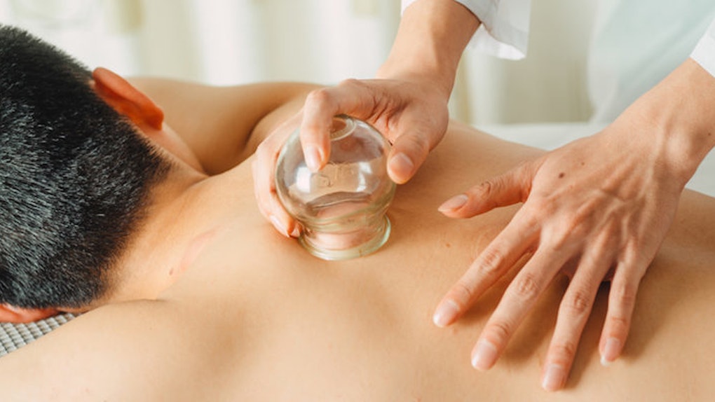 Add Cupping